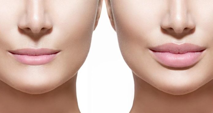 Venus Medical Lip Lift & Perma Lip