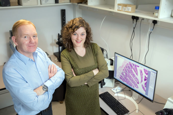 High fat diet increases risk of infection.