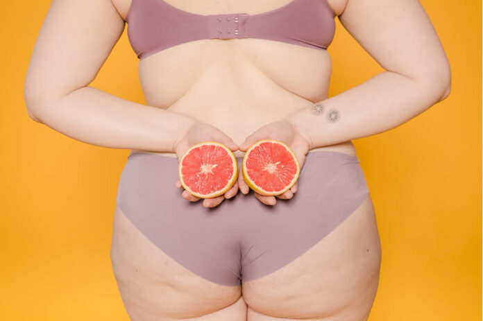 Cellulite