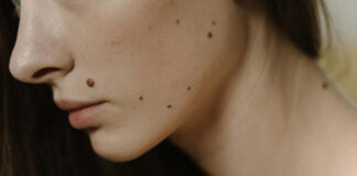 Skin health care with Rose Clinic