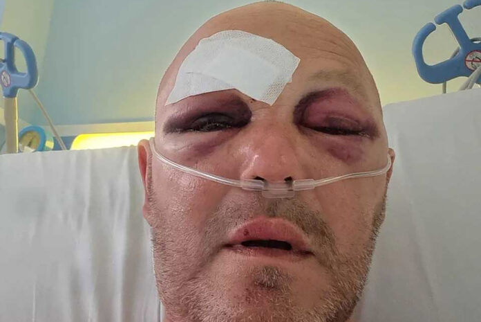 Philip in hospital in Spain.
